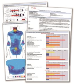 thermografie